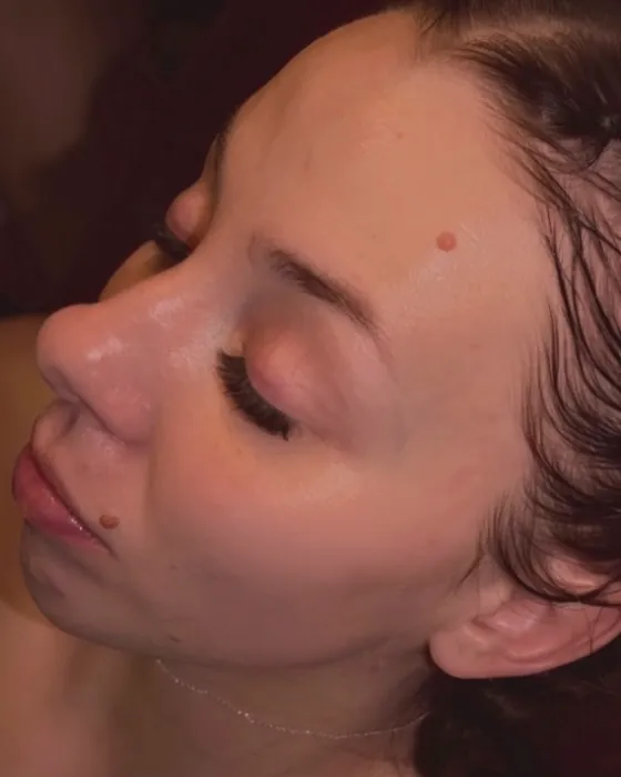 Close-up of a client's skin after a facial.