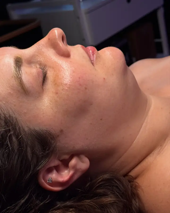 A client resting on the treatment table after her facial, eyes closed, skin calm and glowing.