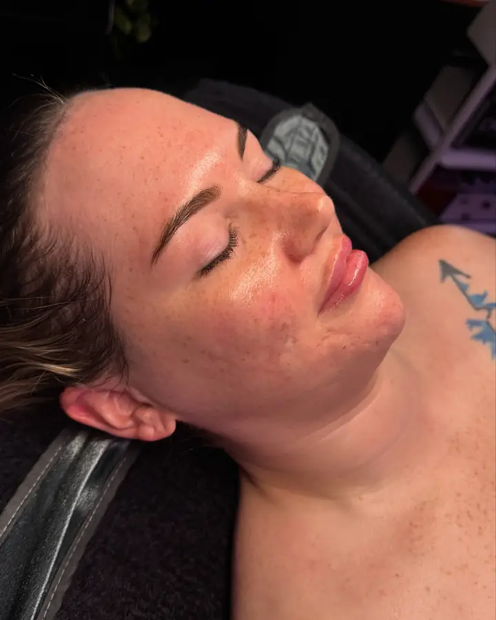 A client with a small arrow tattoo resting after her treatment, skin calm and dewy.